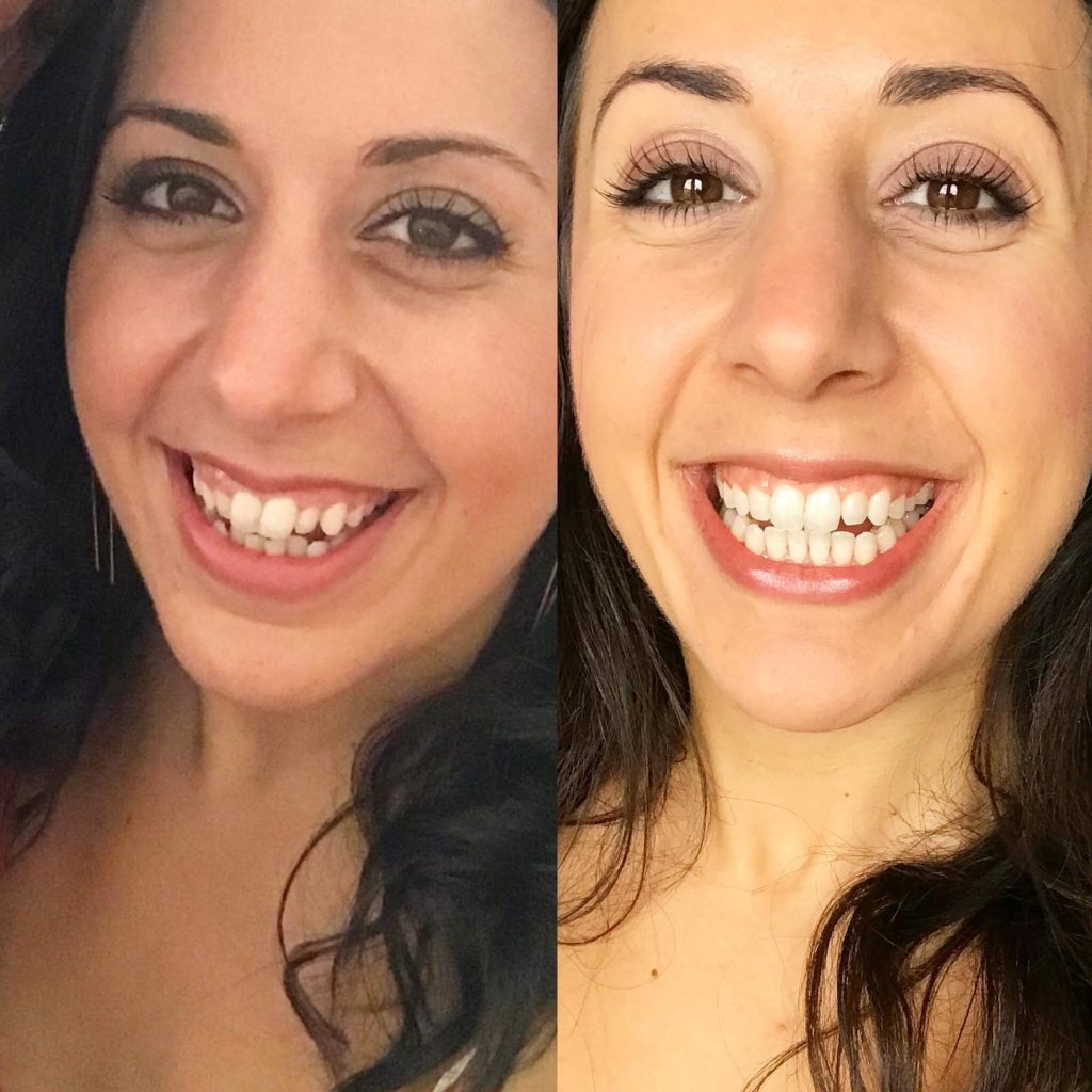 Dentitox Pro - Customer Happy